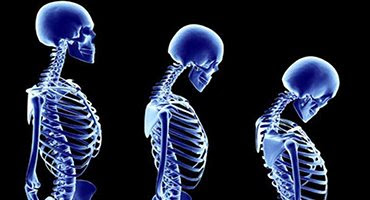 Pandemi ve Kas İskelet Sistemimiz